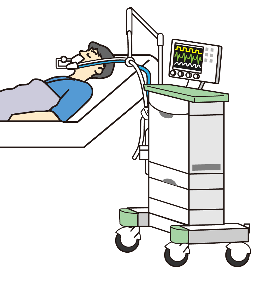人工呼吸療法
